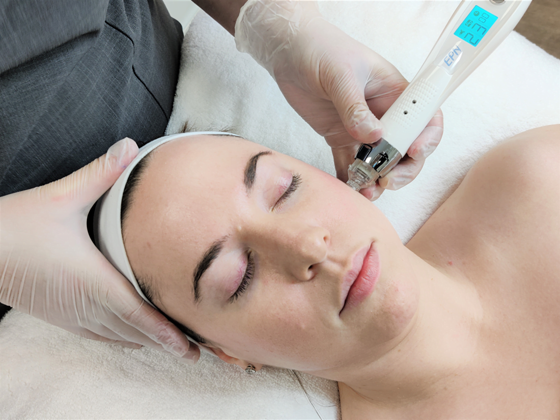 Mesotherapy & Micro Needling